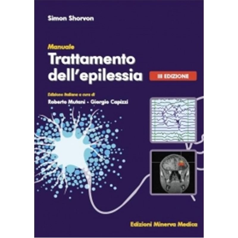 Trattamento dell'epilessia - III edizione (2013)